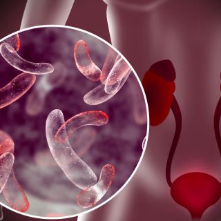 Prevención de infecciones del tracto urinario